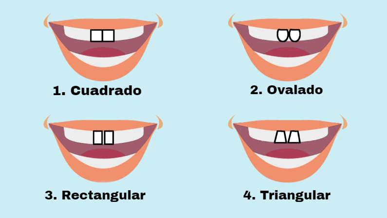 Cámara posibilidad coro La forma de los dientes frontales puede revelar su personalidad:  rectangulares implican liderazgo | The Epoch Times en español