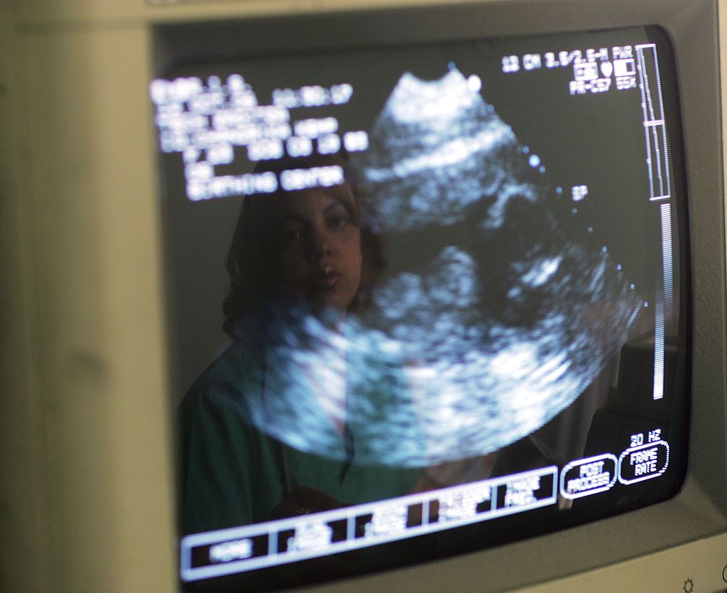 Ley de Indiana exige que las madres se hagan un ultrasonido antes de un  aborto a partir del 1 de enero | Planned Parenthood | Aborto | Ecografía |  The Epoch Times en español